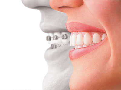 Zen Dentistry | Dental Cleanings, Periodontal Treatment and E4D