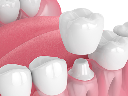 Zen Dentistry | Periodontal Treatment, Emergency Treatment and Orthodontics